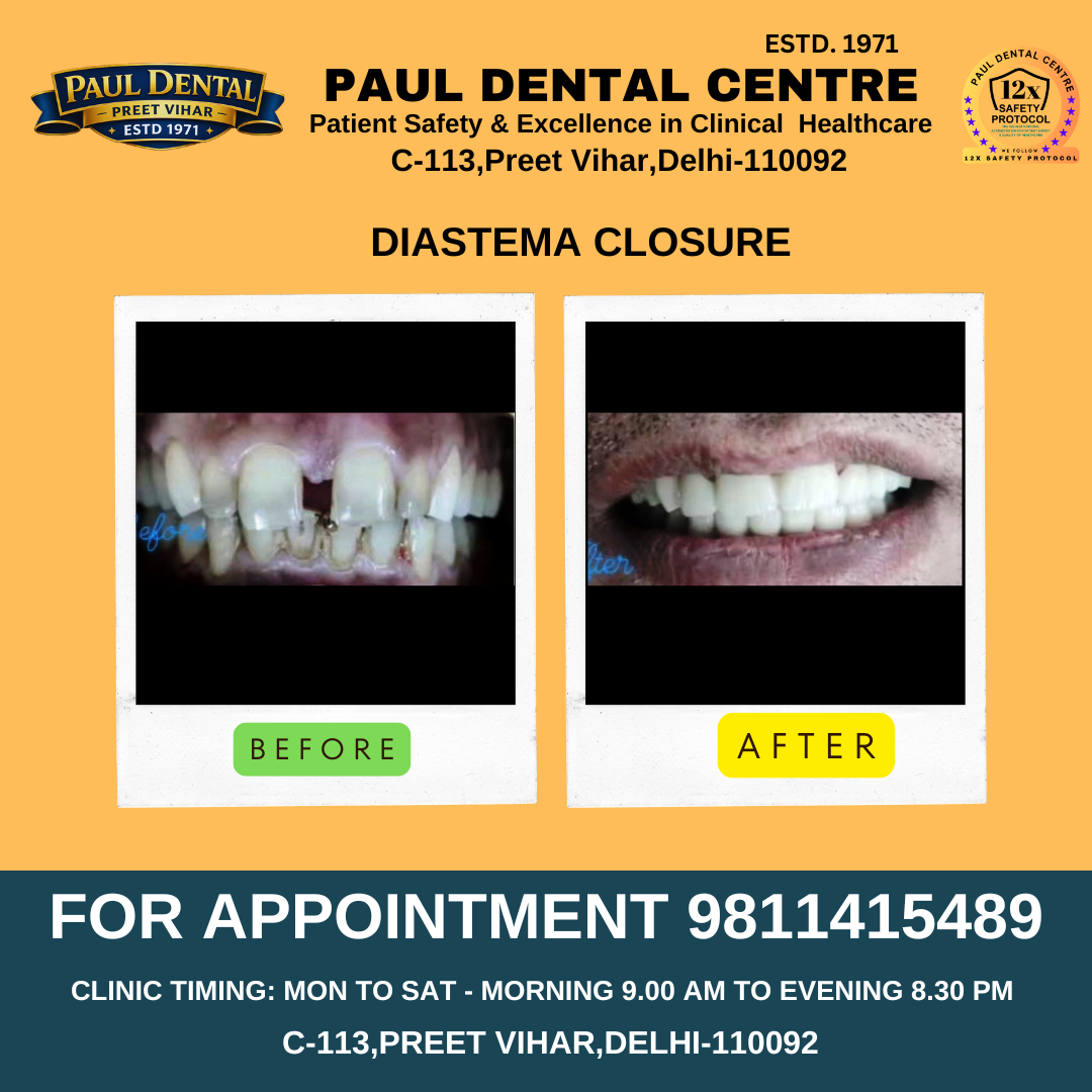 Case 29 – Paul Dental Center